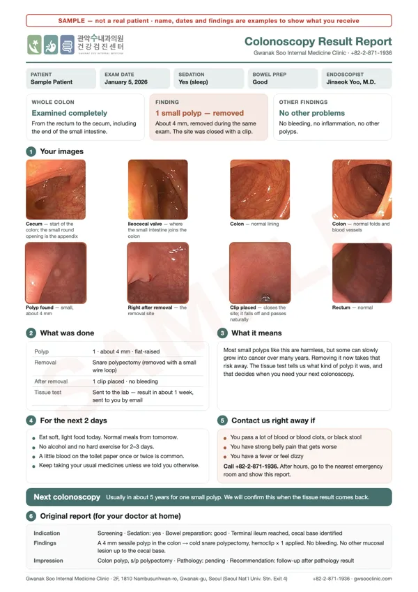 Sample colonoscopy report in English with eight endoscopy images, what was done, what it means, care for the next two days and when the next colonoscopy is due