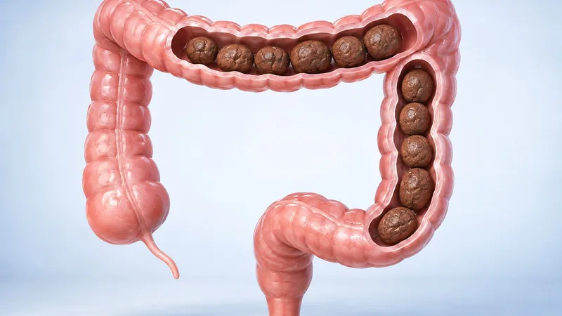 대장에 변이 정체되어 있는 상태를 보여주는 해부 일러스트